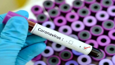 Coronavirus