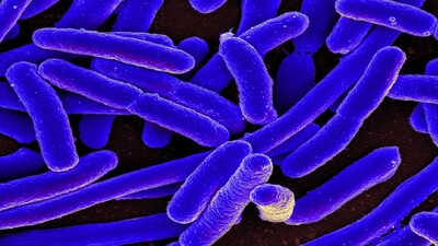 E-coli