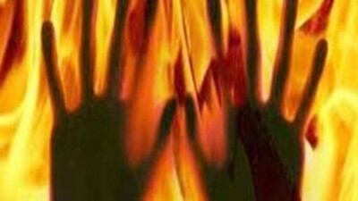 Girl set on fire