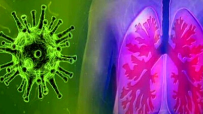 H3N2 Virus