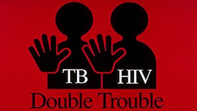 HIV-TB