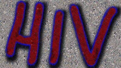 HIV