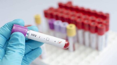 hiv