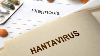 Hantavirus