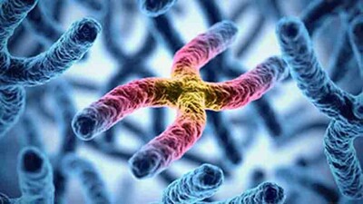 Huntingtons-disease