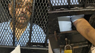 Fugitive Businessman Mehul Choksi Behind Bars! New Viral Pictures Show Injury Marks