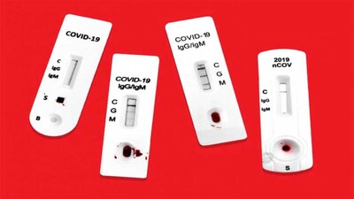 Covid-19 antibody Test