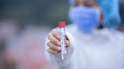 Covid RTPCR Tests In Odisha 