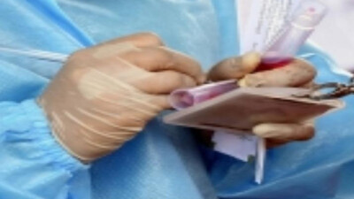 Measuring viral RNA may help predict which Covid patients will die
