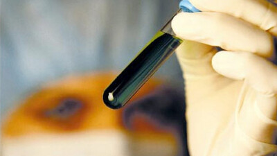 Russia Reveals Documents Of Labs Developing Biological Weapons In Ukraine Funded By The US