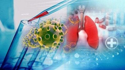 Covid Pneumonia