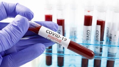 India-COVID-19-Cases