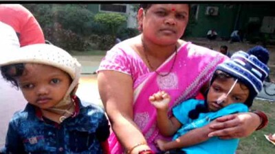 Odisha's Separated Craniopagus Twin Kalia No More | OTV News