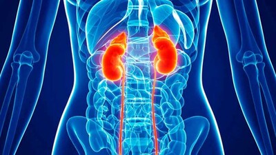 Kidney-cancer