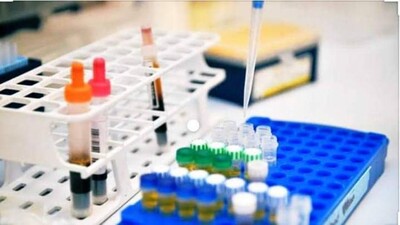 Lab test
