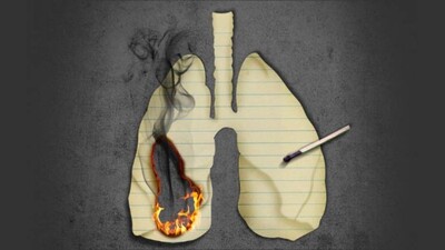Lungs22