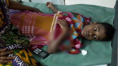Odisha: 2 School Kids Injured In Mobile Phone Battery Blast In Ganjam