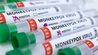 Monkeypox