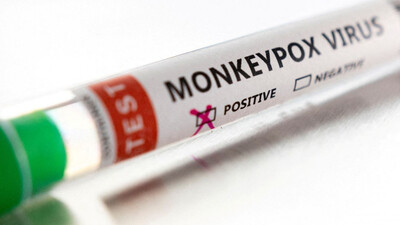 Monkeypox