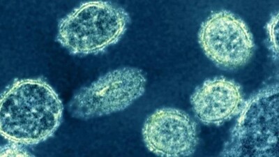 New-Swine-Flu