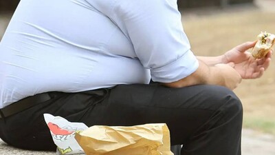 Obesity