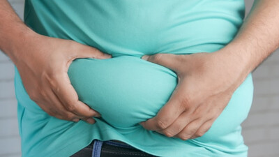 Obesity