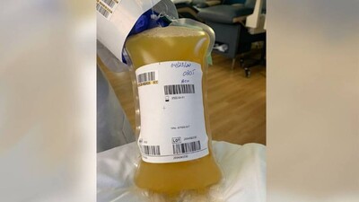 Plasma-Therapy