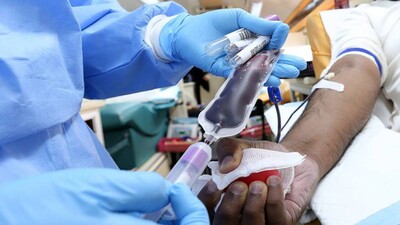 COVID-19: ICMR Mulling To Remove Plasma Therapy From Treatment Protocol