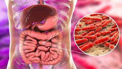 Probiotic-treatment-Intestine
