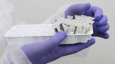 Rapid-Antigen-kit