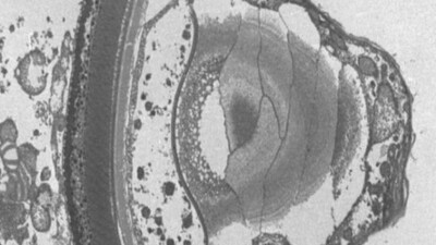 Single-celled-plankton-has-a-human-like-eye