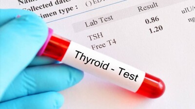 Thyroid