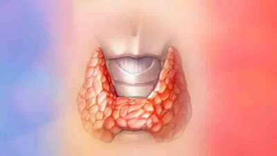 Long working hours can cause underactive thyroid