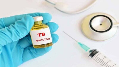 Tuberculosis-Vaccine