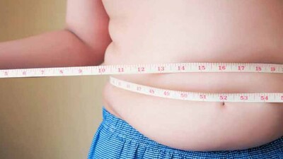 Weight-Loss-Surgery