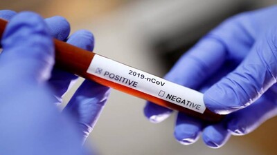 antibody-test