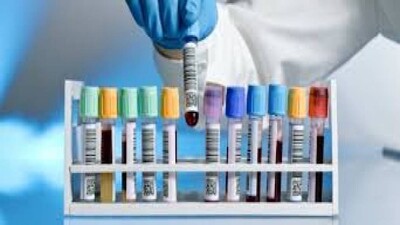 blood test
