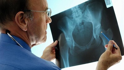 bone-health