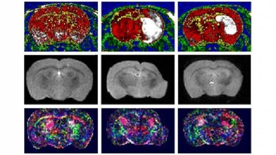 brain-tissue
