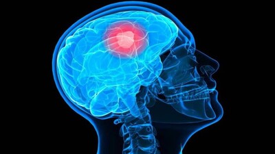 brain_