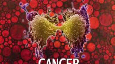 cancer
