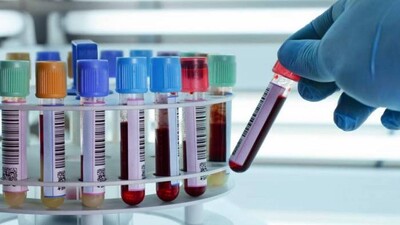 cancer-blood-test
