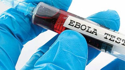 Ebola virus