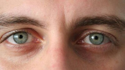 eyebrows