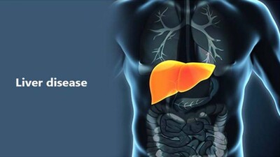 liver-disease