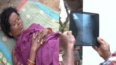 Odisha: Doctor Leaves Broken Needle In Woman's Uterus During Family Planning Operation In Koraput