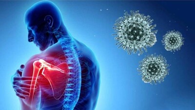 neurological disorder Covid-19 symptom
