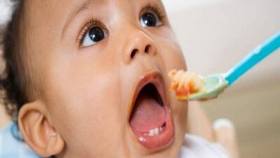 obesity baby