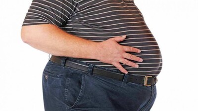 obesity