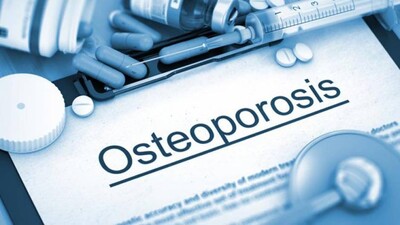 Osteoporosis